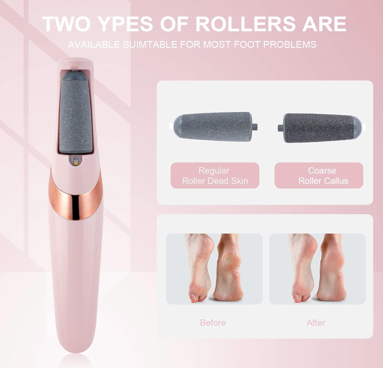 ELE:[Electronic Foot Grinder]-Electric Foot Callus Remover For Smooth Heels With Replaceable Heads